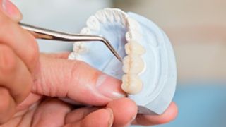 blanqueamientos dentales en granada Clínica DM Dental